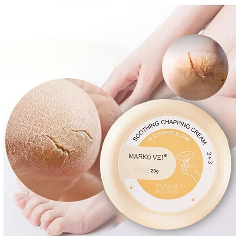 Winter Anti-kraak crème