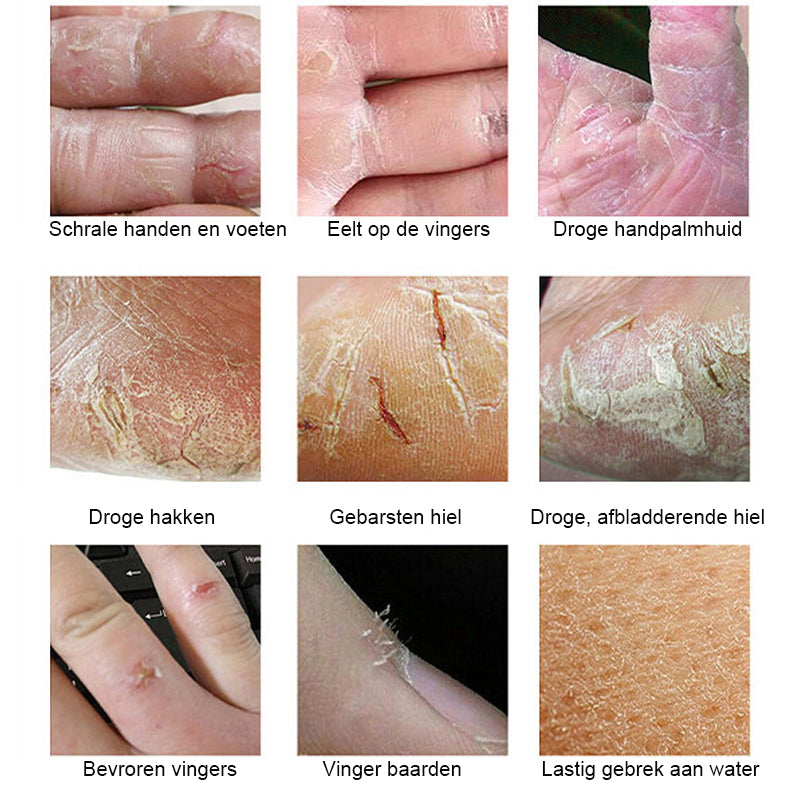 Anti-kraak wintercrème