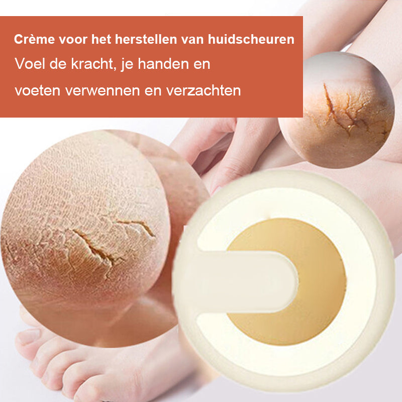 Anti-kraak wintercrème