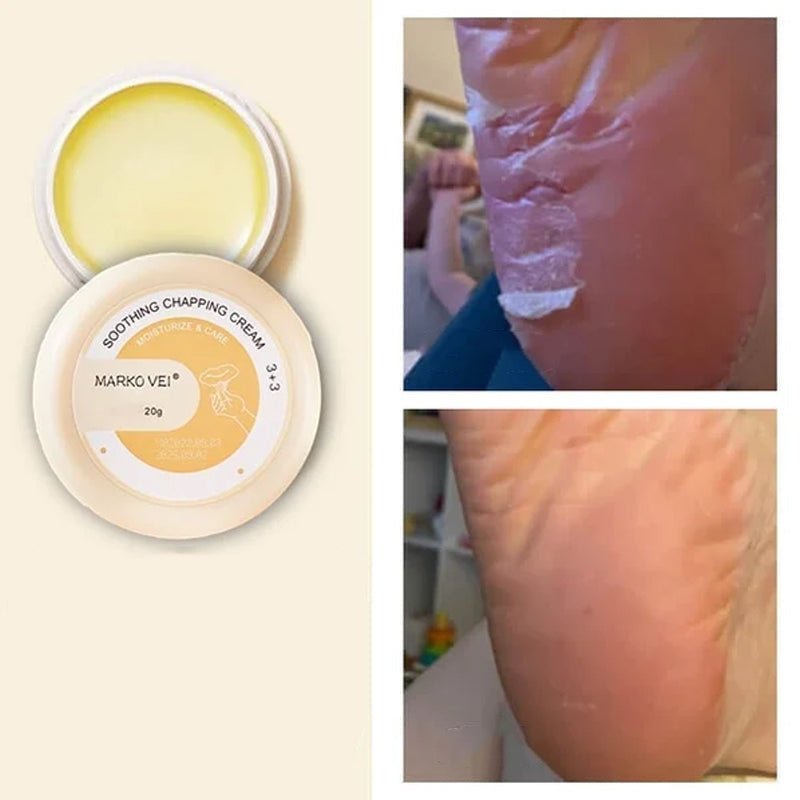 Winter Anti-kraak crème