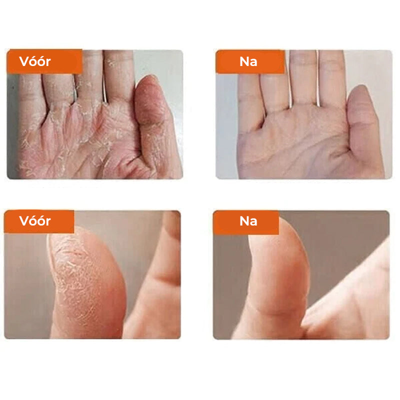 Winter Anti-kraak crème