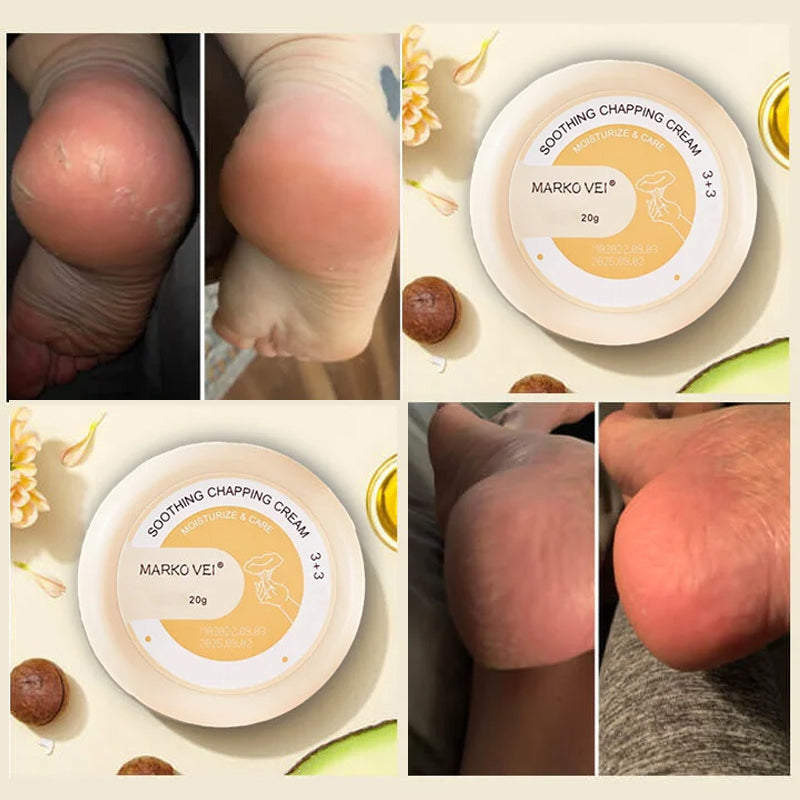 Winter Anti-kraak crème