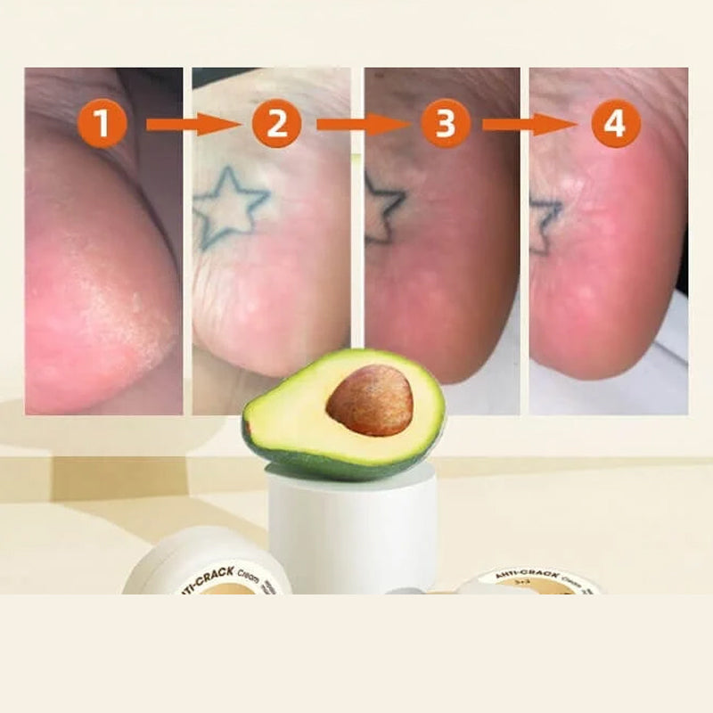 Winter Anti-kraak crème