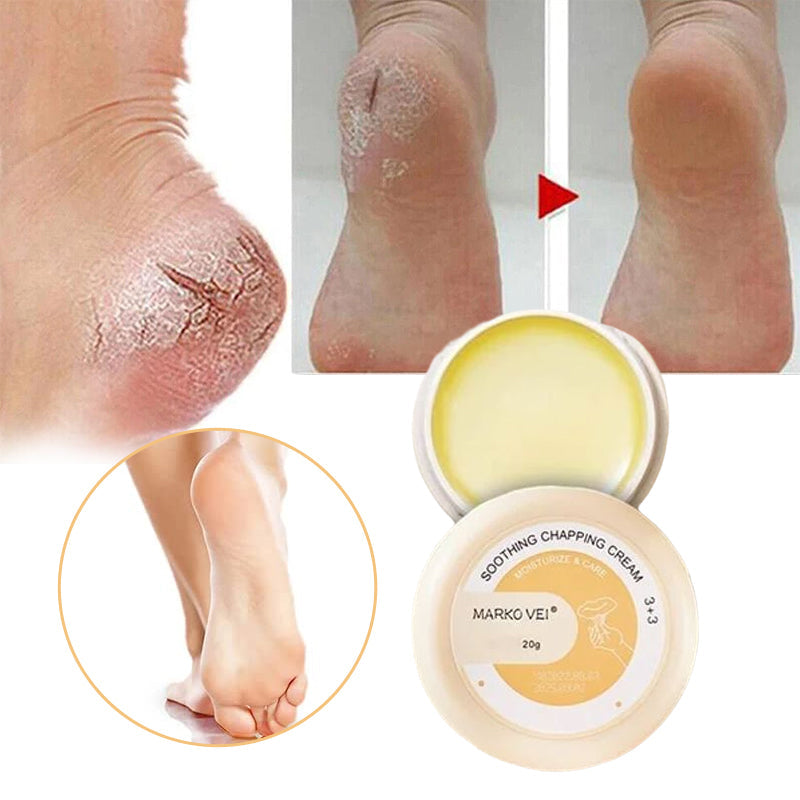 Winter Anti-kraak crème