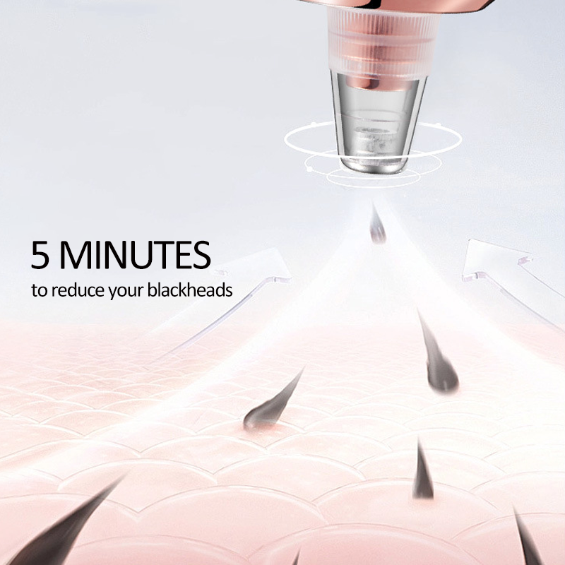 Vacuüm voor het verwijderen van mee-eters