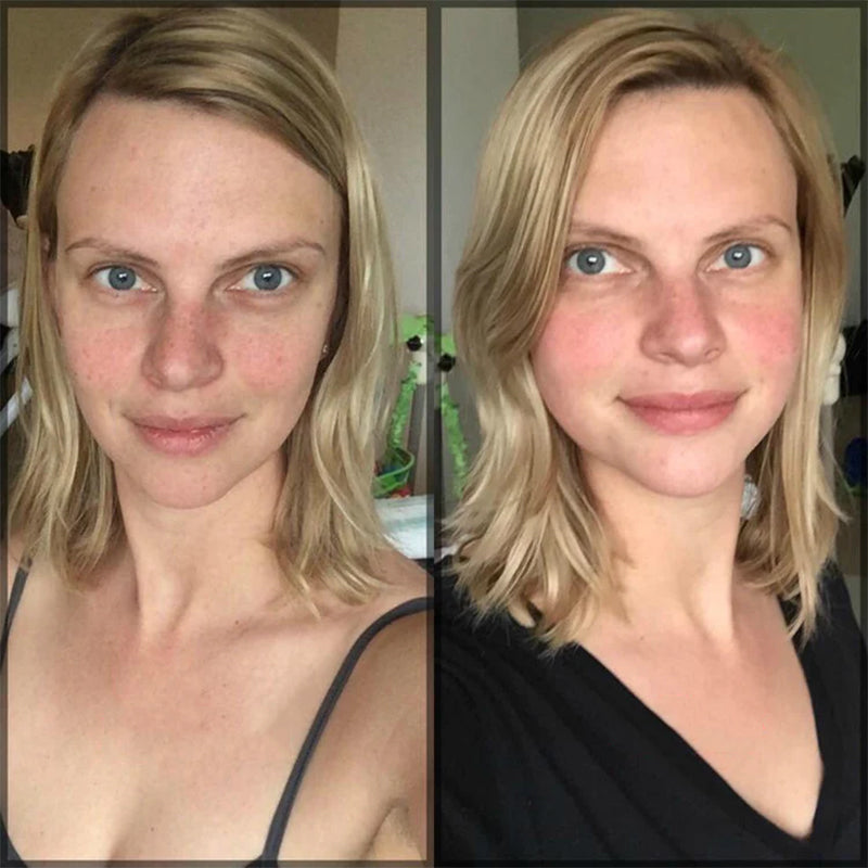 MICROCURRENT GEZICHTSCULPTEERAPPARAAT