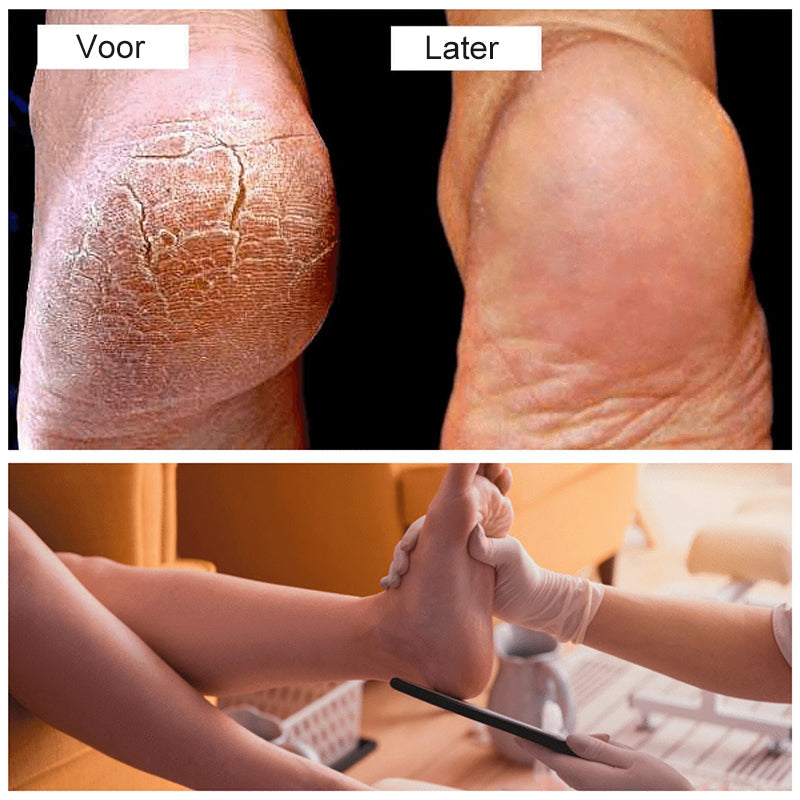 Pedicure  Voet Bestand