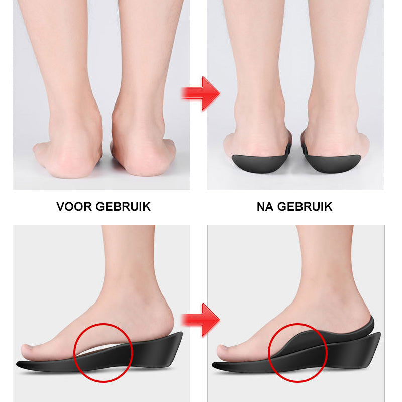 Orthopedische inlegzolen voor platte voeten