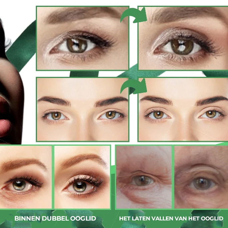 Onzichtbare dubbele ooglidstrips