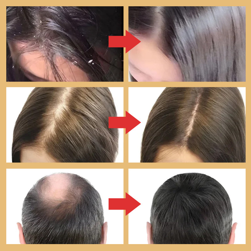 Gladde en oliecontrolerende anti-haaruitvalshampoo