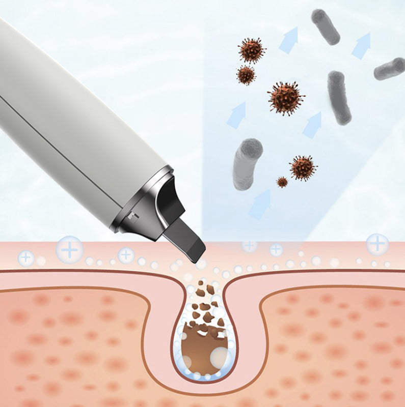 Mini Ultrasonic 2 in 1 Multi-Functional Skin Vacuum