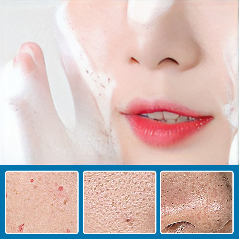 Tokyo Oligopeptide Kleine Luchtbel Reinigingsessentie 10st