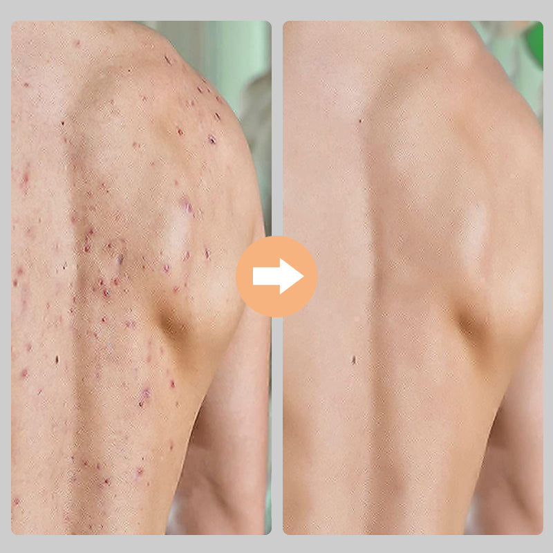 Slimme exfoliërende handschoenen