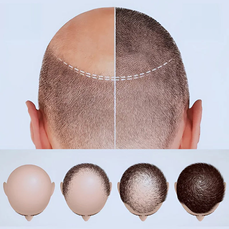 Gladde en oliecontrolerende anti-haaruitvalshampoo