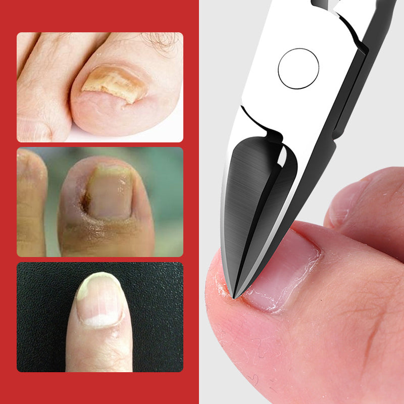 Roestvrijstalen nagelgroef olecranon clipper